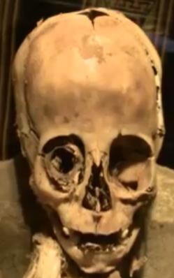 elongated skull