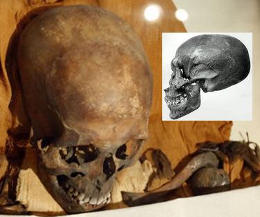 elongated skull of Akhenaten
