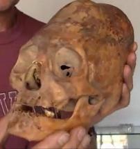 elongated skull